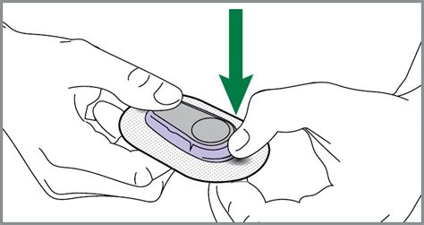 5 Easy Steps For Dexcom Sensor Replacement