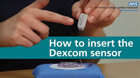 5 Easy Steps To Replace Dexcom Sensor Form