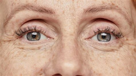 5 Ways To Define The Combining Form Of Eyelid