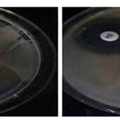 Ctx Antibiotic Full Form: Cefotaxime Explained