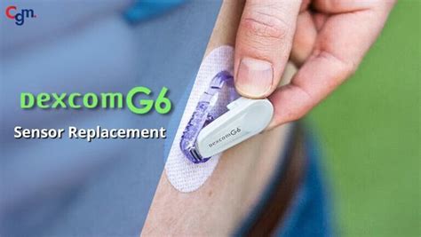 Dexcom G6 Sensor Replacement Form: A Step-By-Step Guide