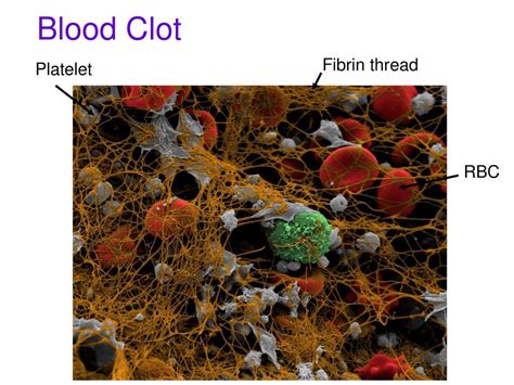 Fibrin Threads: The Building Blocks Of Blood Clots