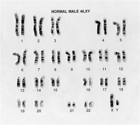 Karyotype Meaning: Uncovering The Karyo Root