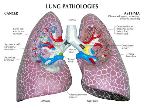 Lung Sections Combining Form Revealed