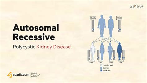 Pkd Autosomal Recessive Form: Causes And Characteristics