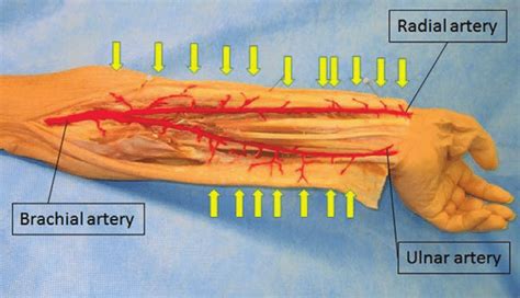 Splits To Form Radial And Ulnar Arteries Explained