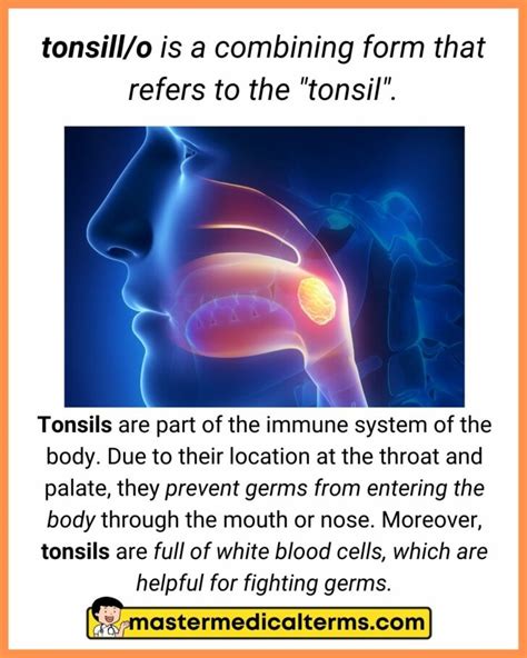 Tonsill(O)-: The Combining Form For Tonsil